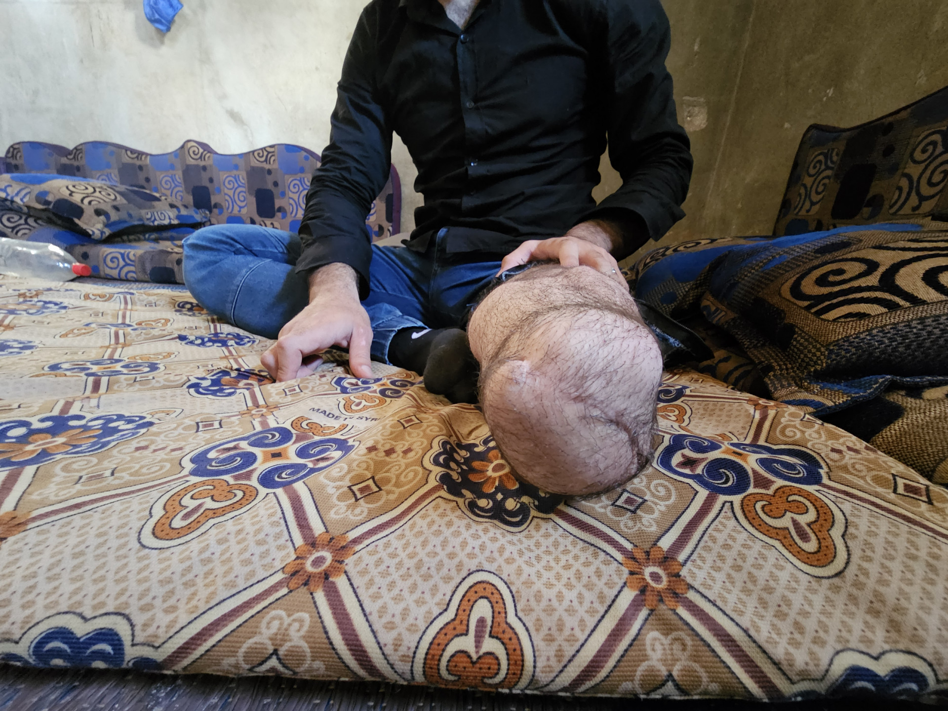 Ali… Fighting Life’s Hardships on One Leg