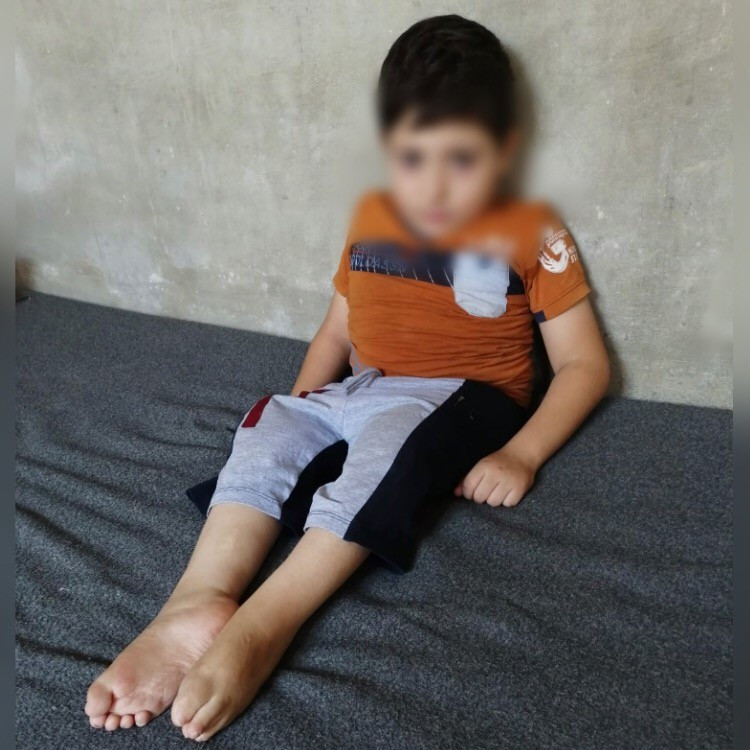 A kid was born with paralysis
