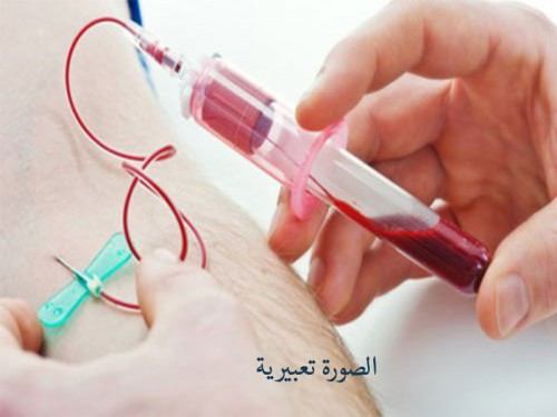 Amal, in need for corneal transplant procedure
