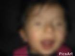 A child needing a lacrimal duct operation