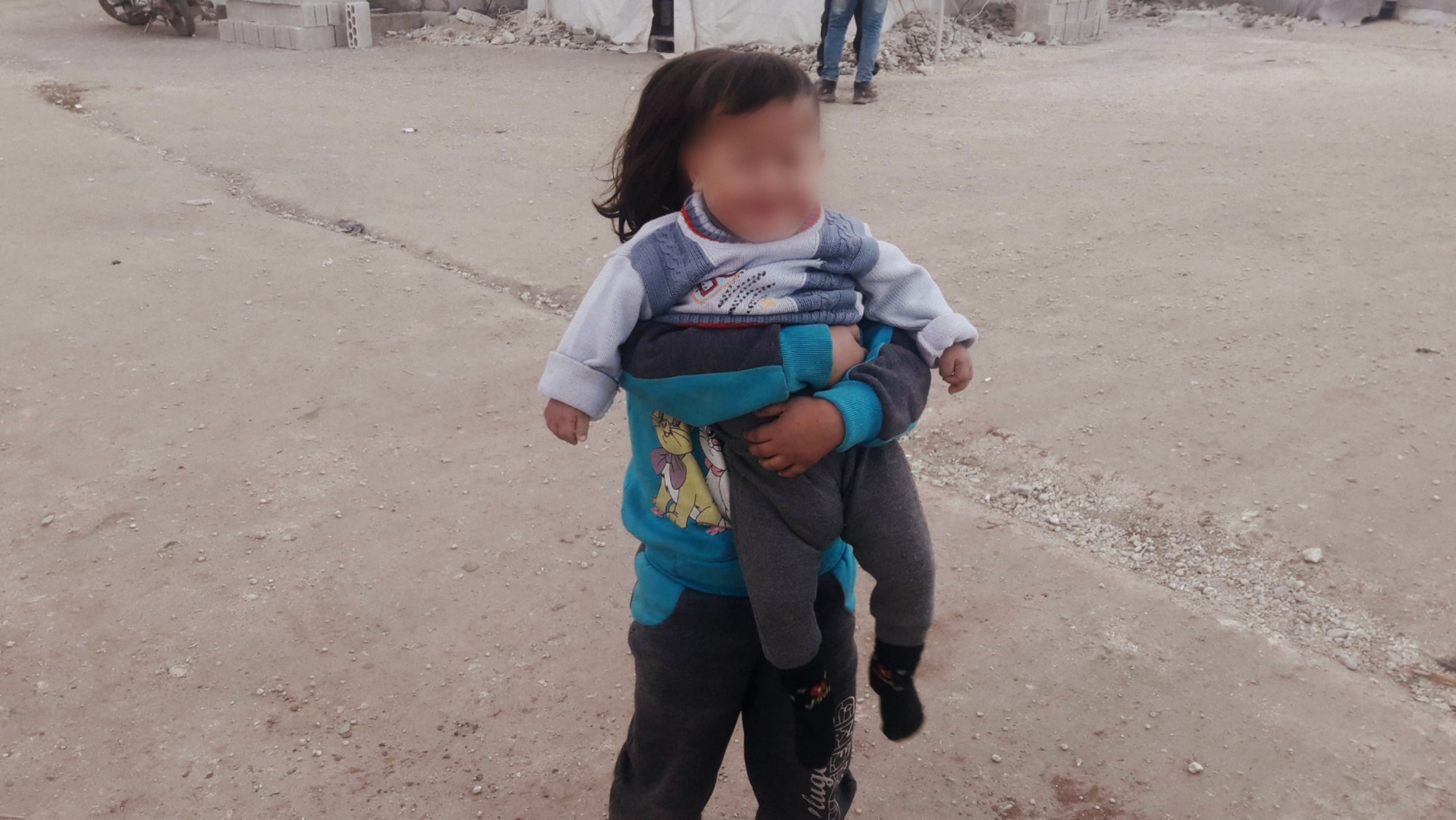 A child with brain atrophy