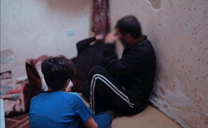 Fadiya is with burns