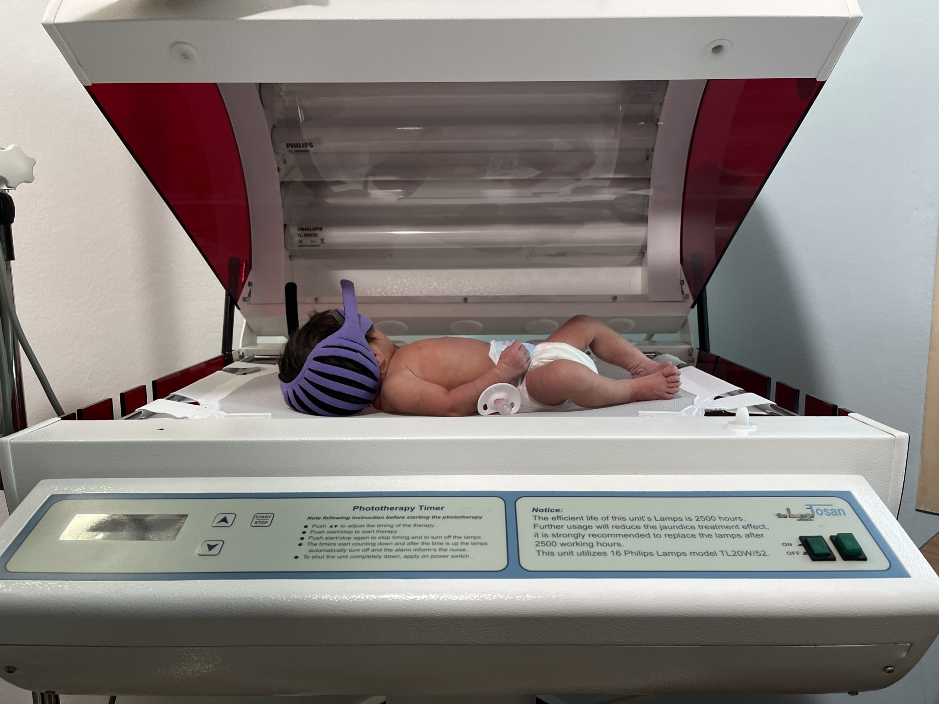 Gaza was born with severe jaundice that is threatening her liver.