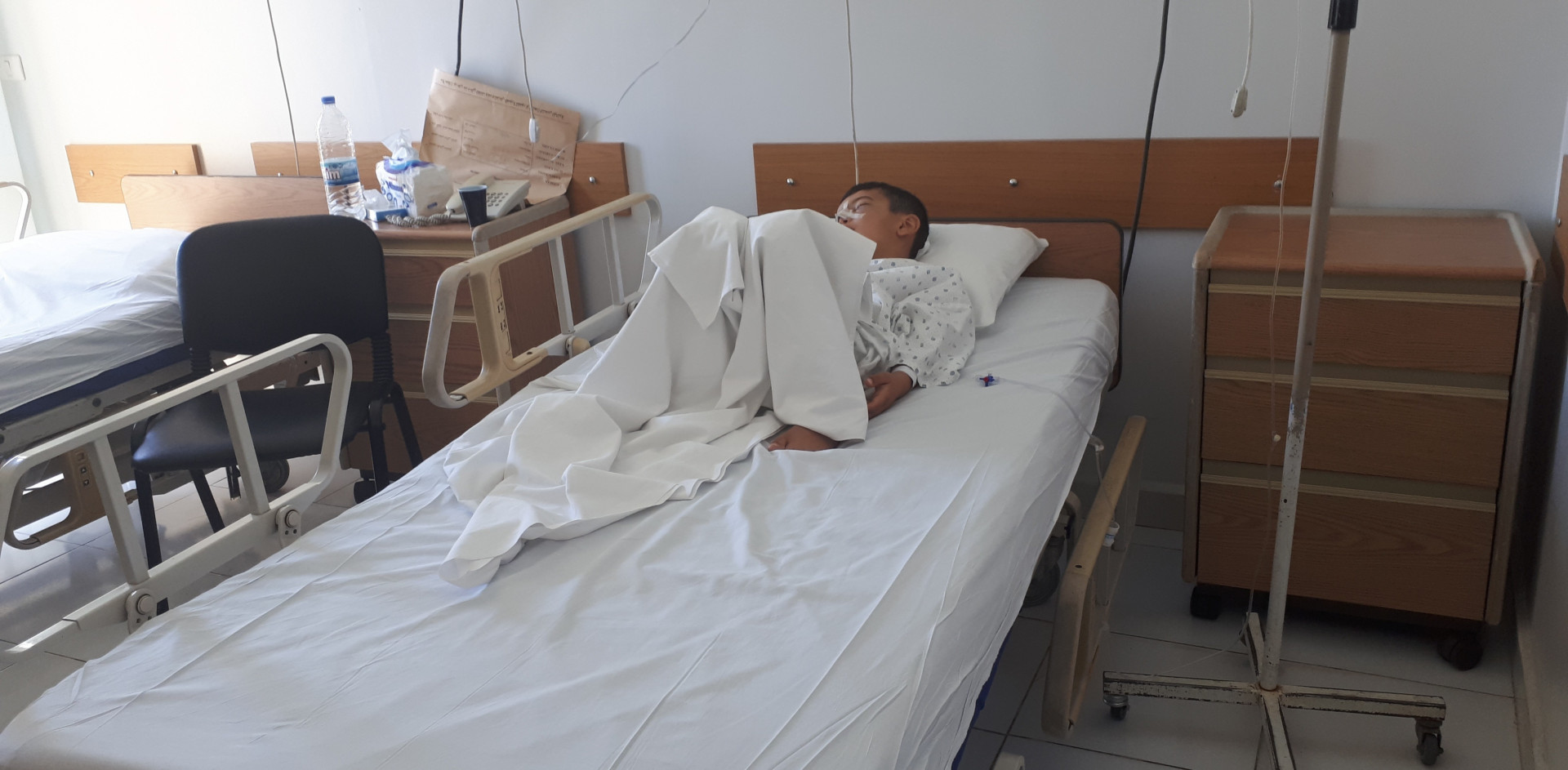A child with 3 fractures
