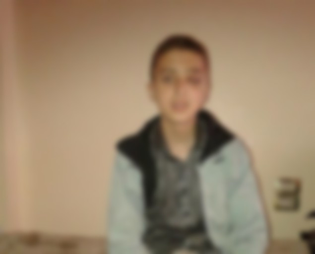 A young man in need for an alternative eye transplantation