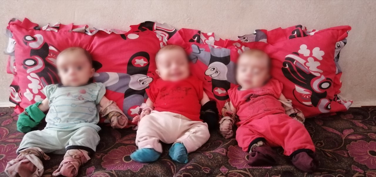 Khattab has triplets suffering from pemphigus