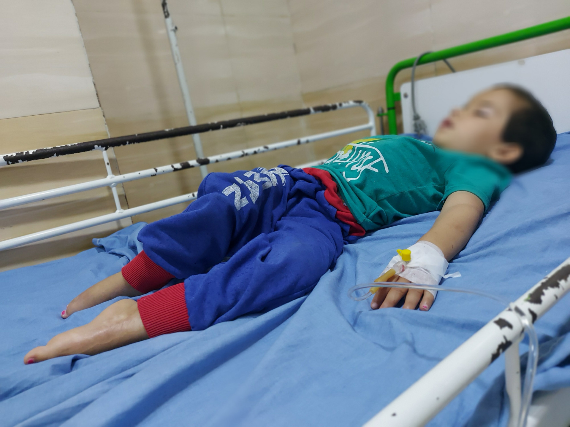 A little child needs cerebral shunt surgery