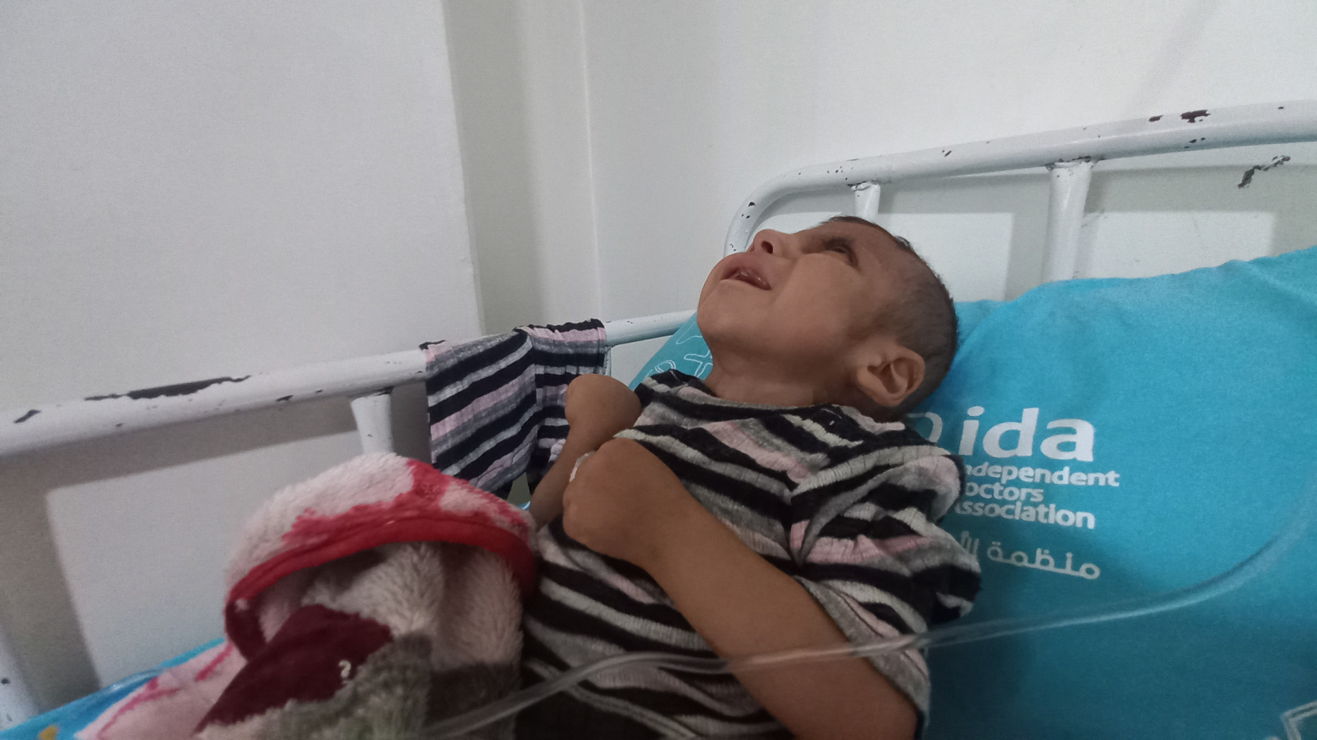A child has cerebral atrophy