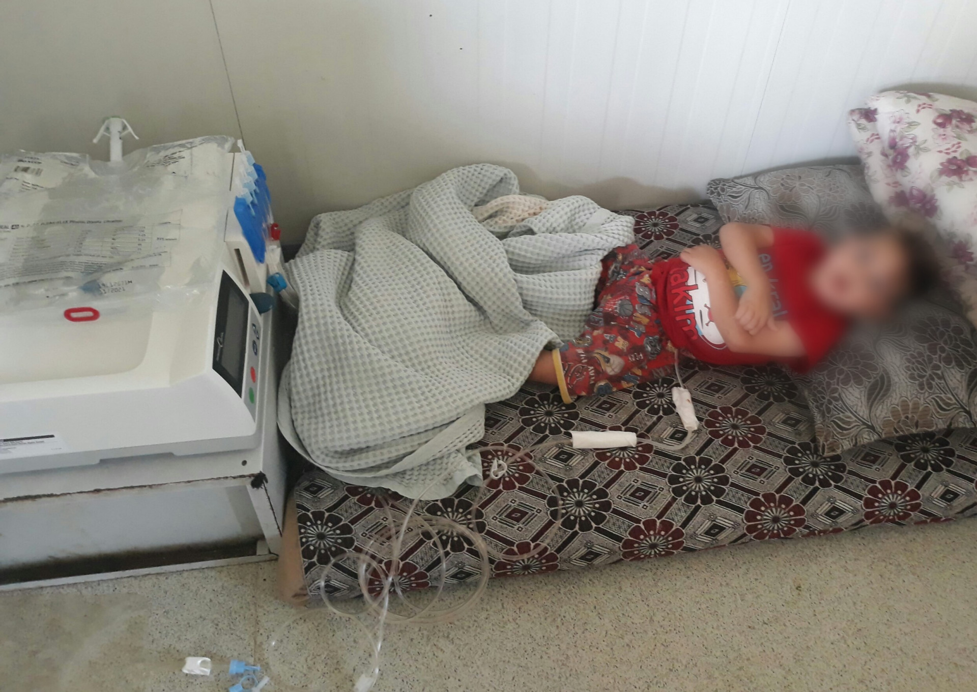A kid with acute renal failure