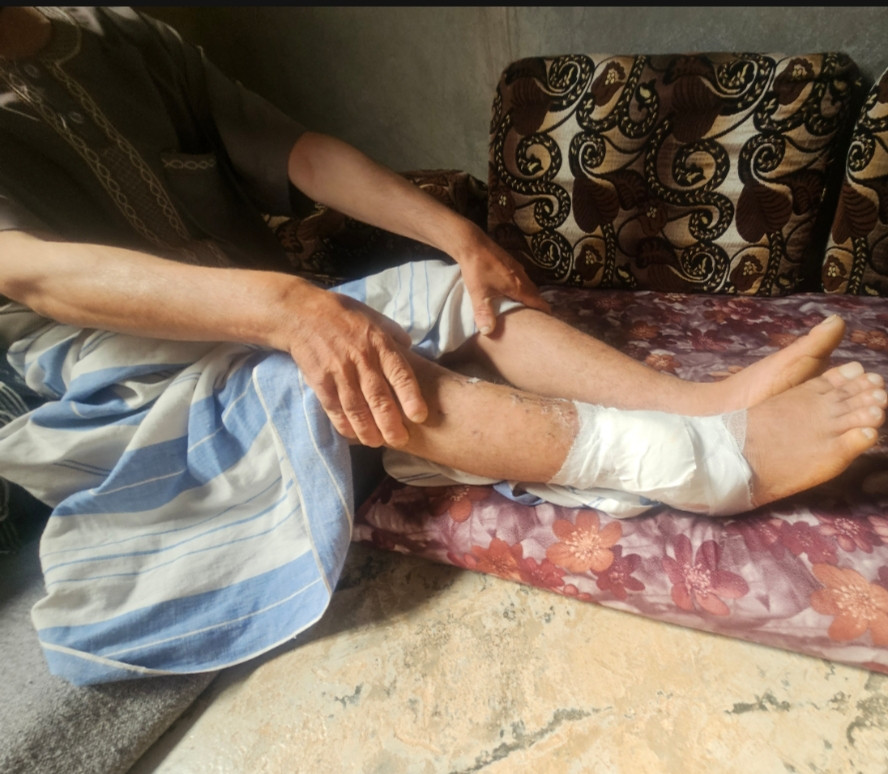 أحمد… المرض والإصابة أثقلا كاهل أسرته
