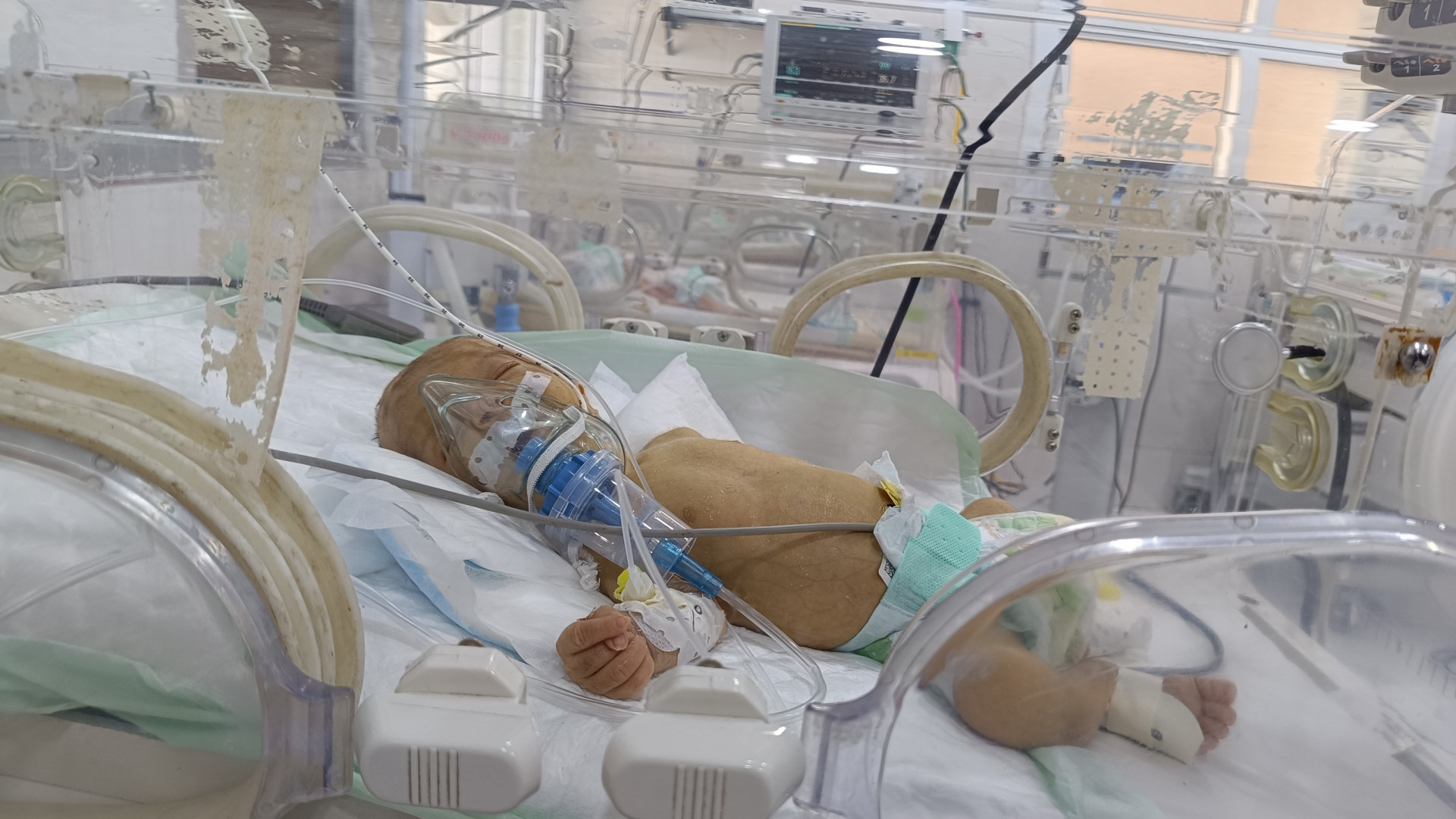 Ali is an infant who has no control over the pain he's feeling, so be the way to relieve his pain and treat it