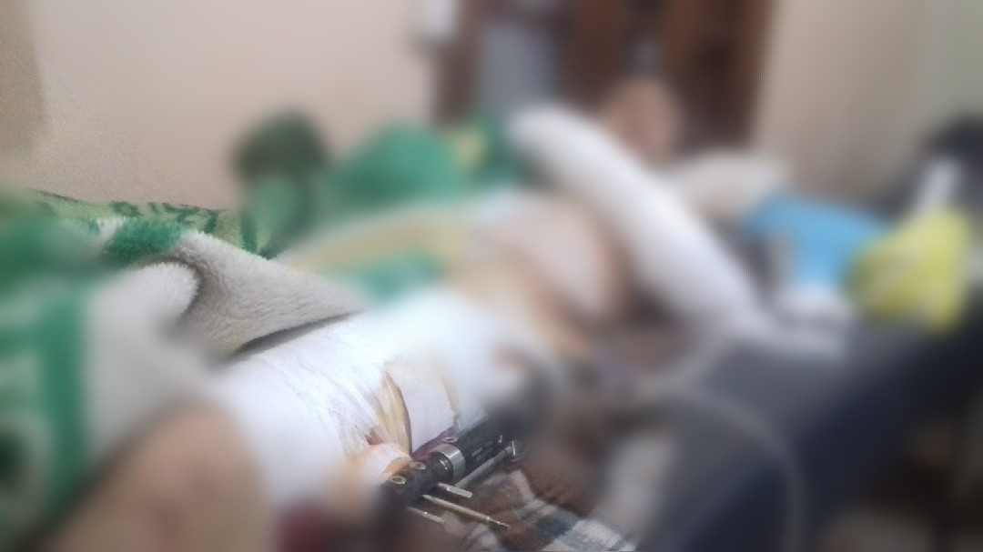 man needs immediate surgery