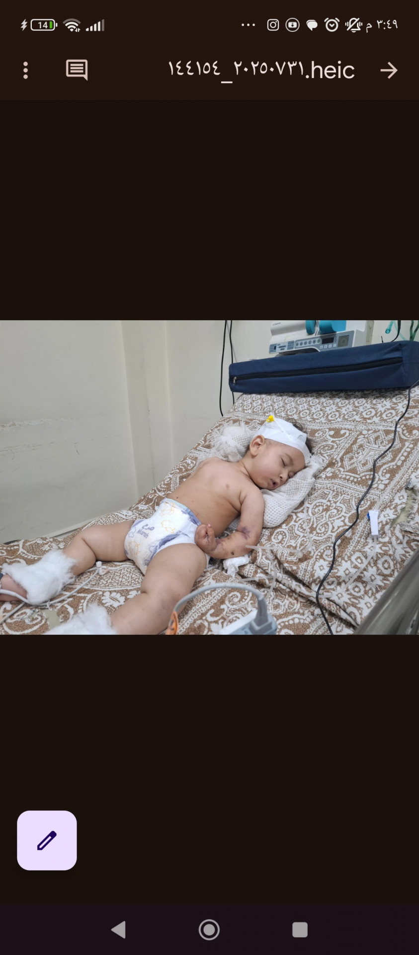 A child is in a critical condition and in intensive care!
