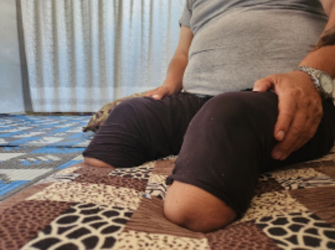 An Electric Wheelchair to Ease Othman’s Suffering