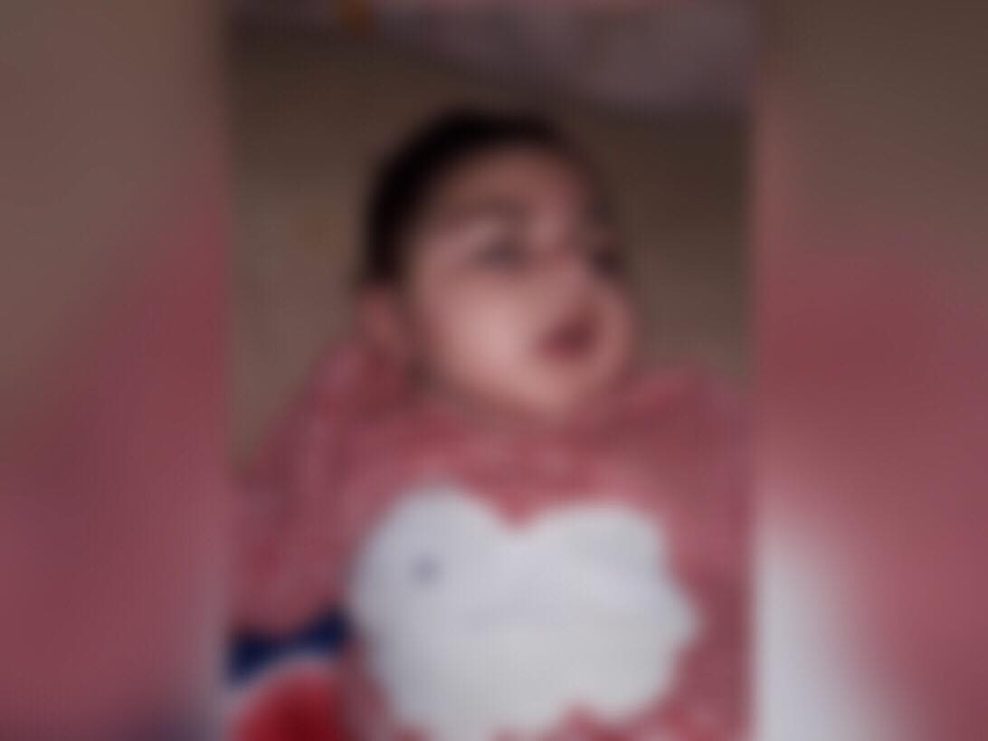 A baby suffering from cerebral atrophy