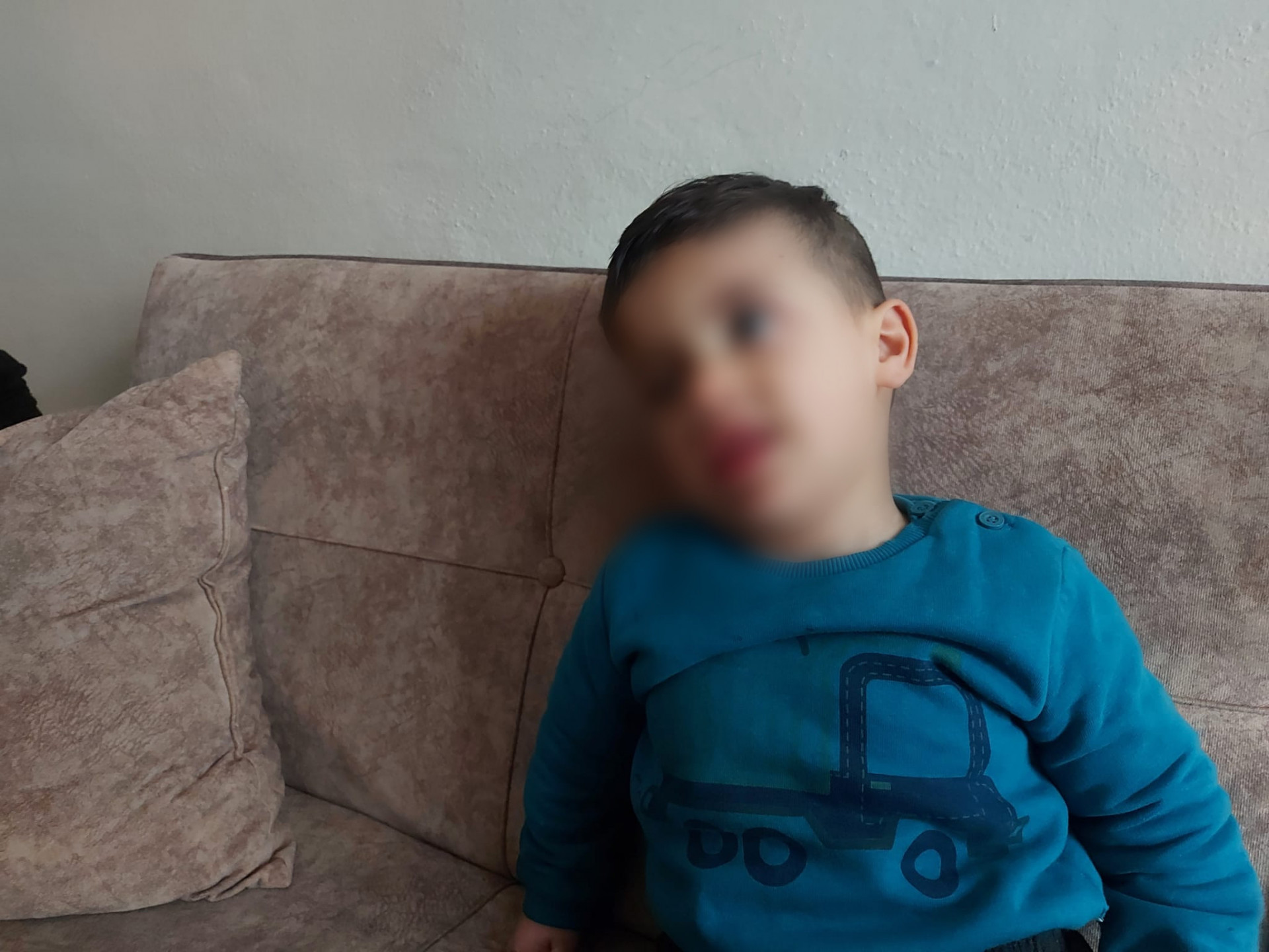 A young child needs in need of surgery to repair droopy eyelids