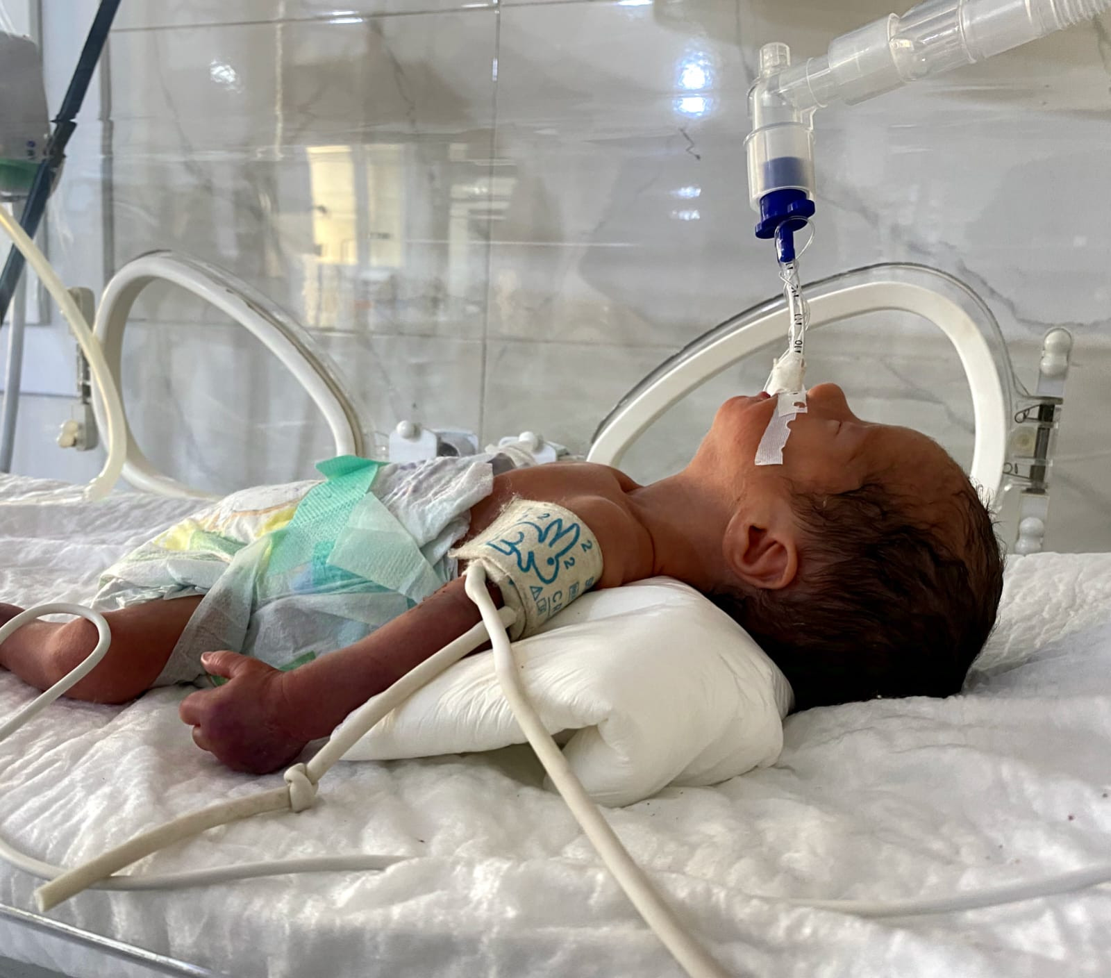 Majid needs medication and treatment expenses