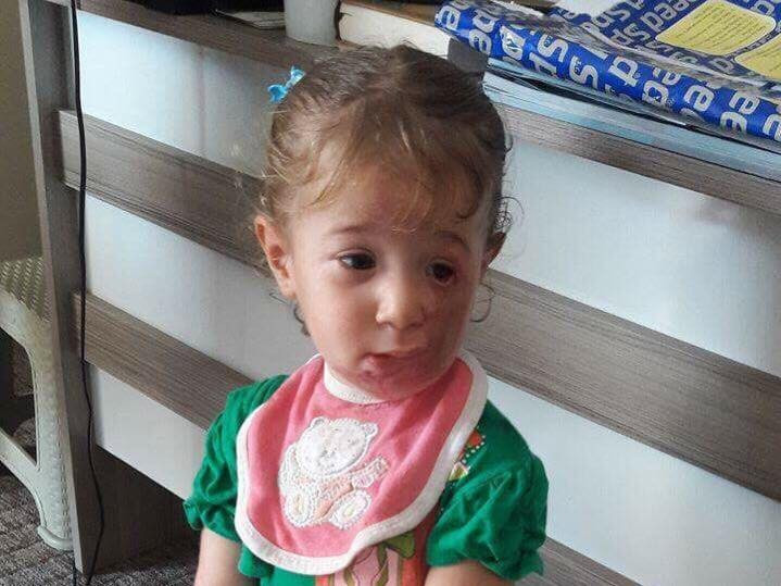 Child needing treatment expenses