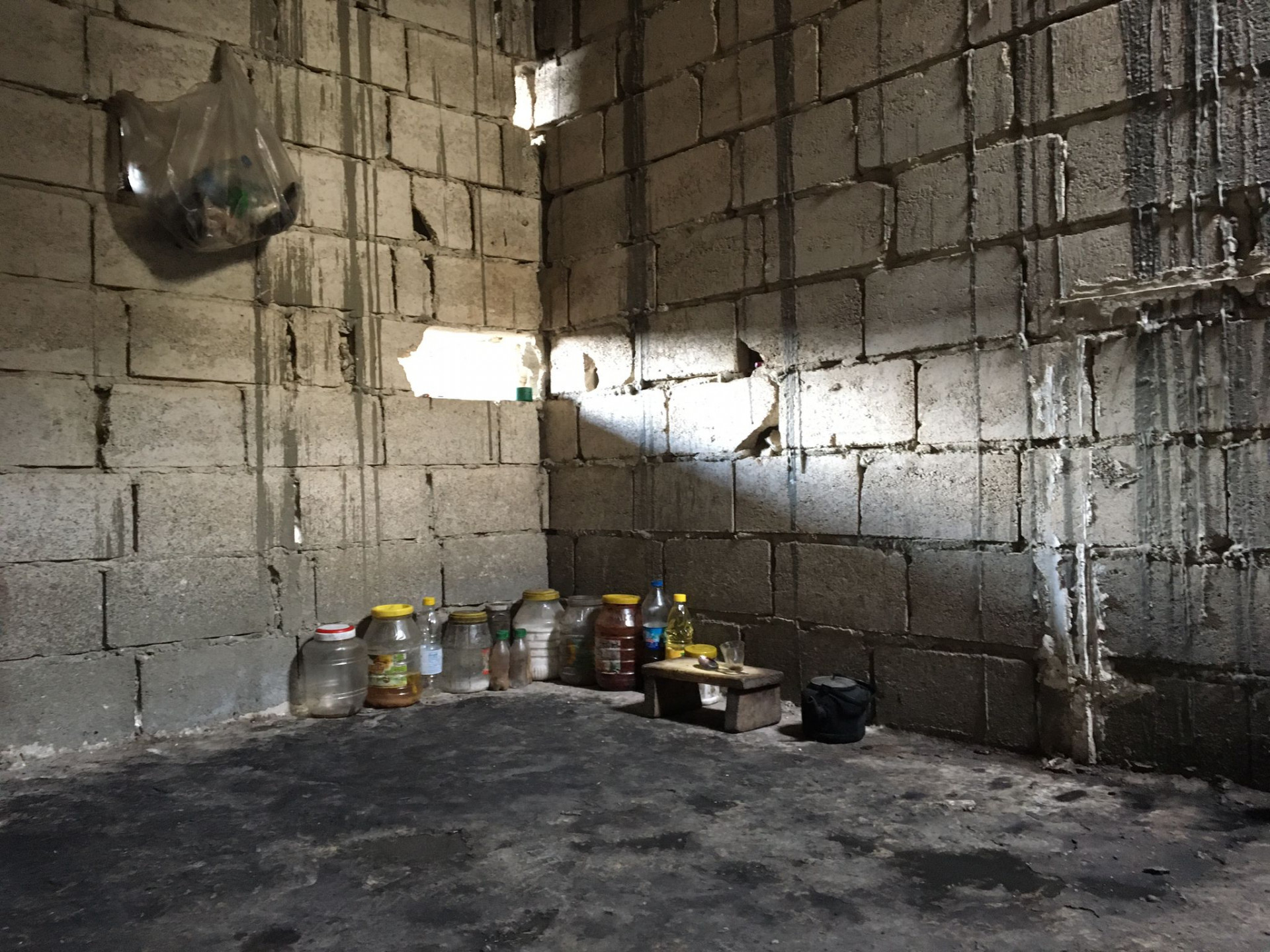 Ahmed suffers from difficult living conditions