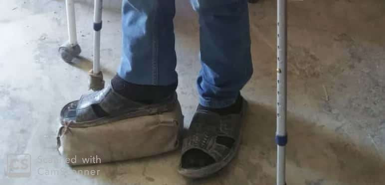 He has a foot disability and needs your help!