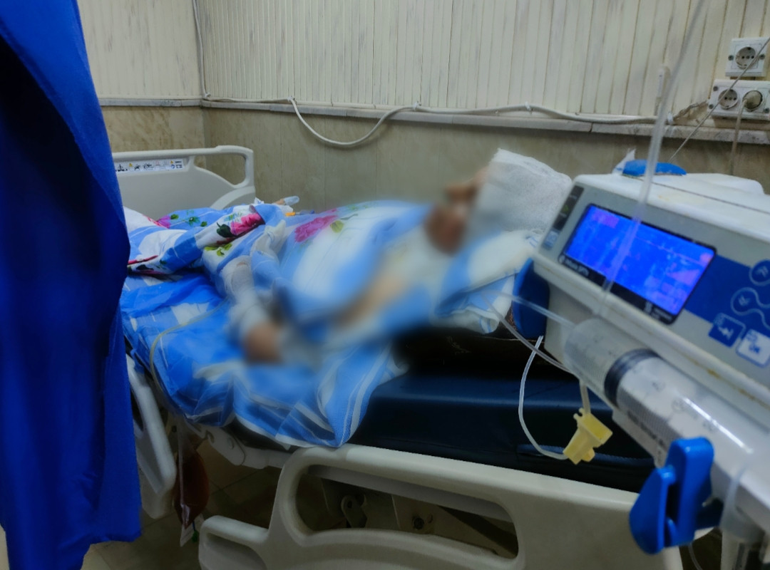 الخالة فاطمة… حروق مؤلمة غيّرت حياتها