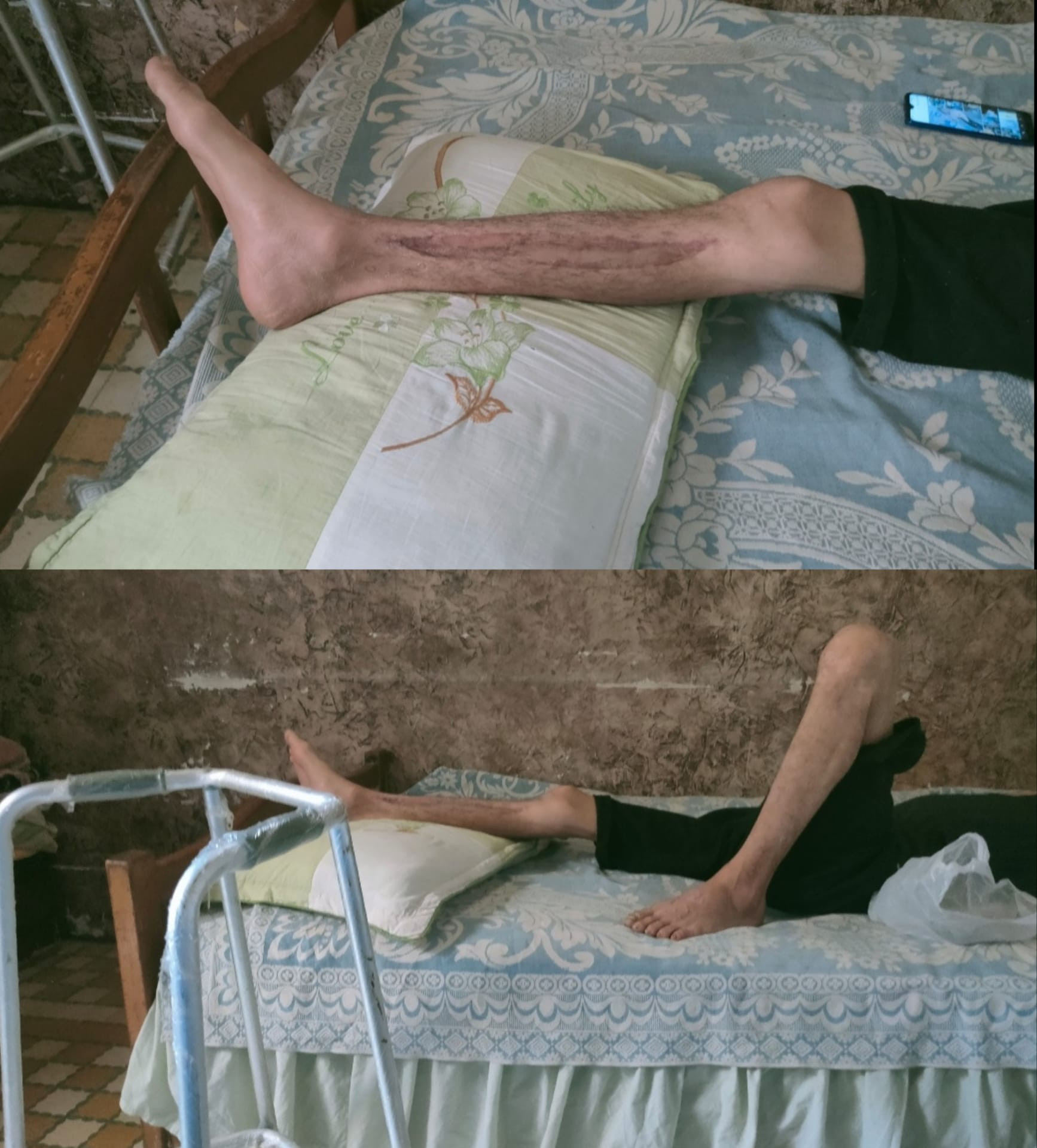 He got out of the rubble very miraculously and he needs help to continue his treatment