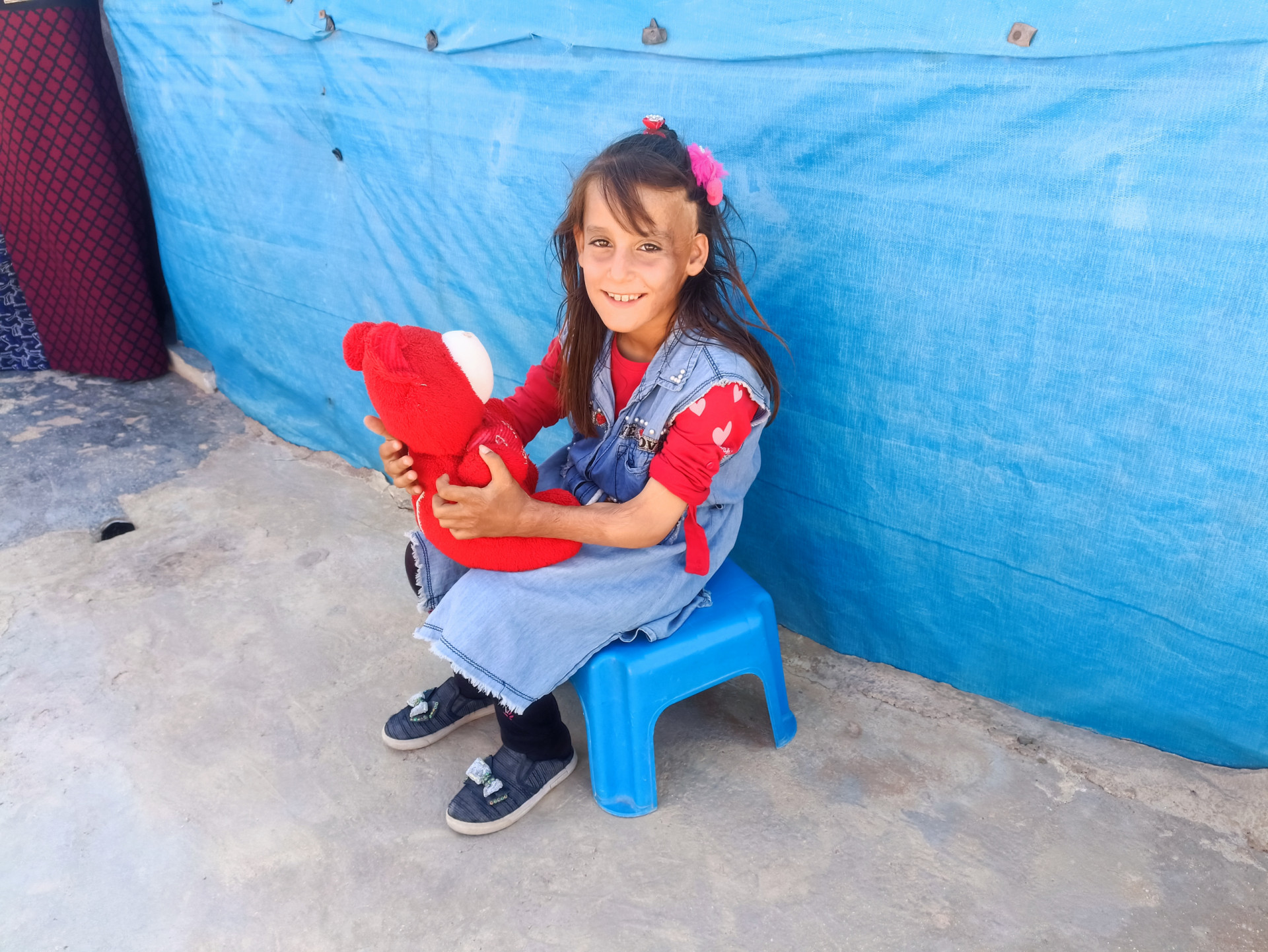 Little Farah suffers from burns all over her body.
