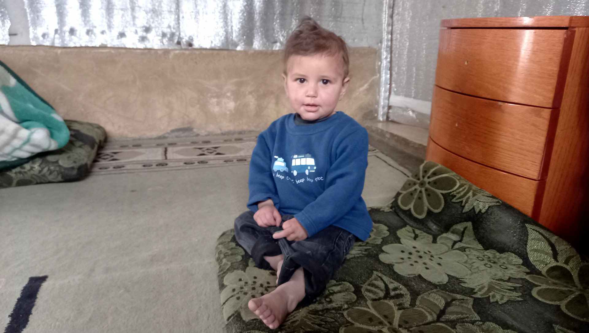 طفل عمره سنة ونصف يعاني ألماً لايطاق!