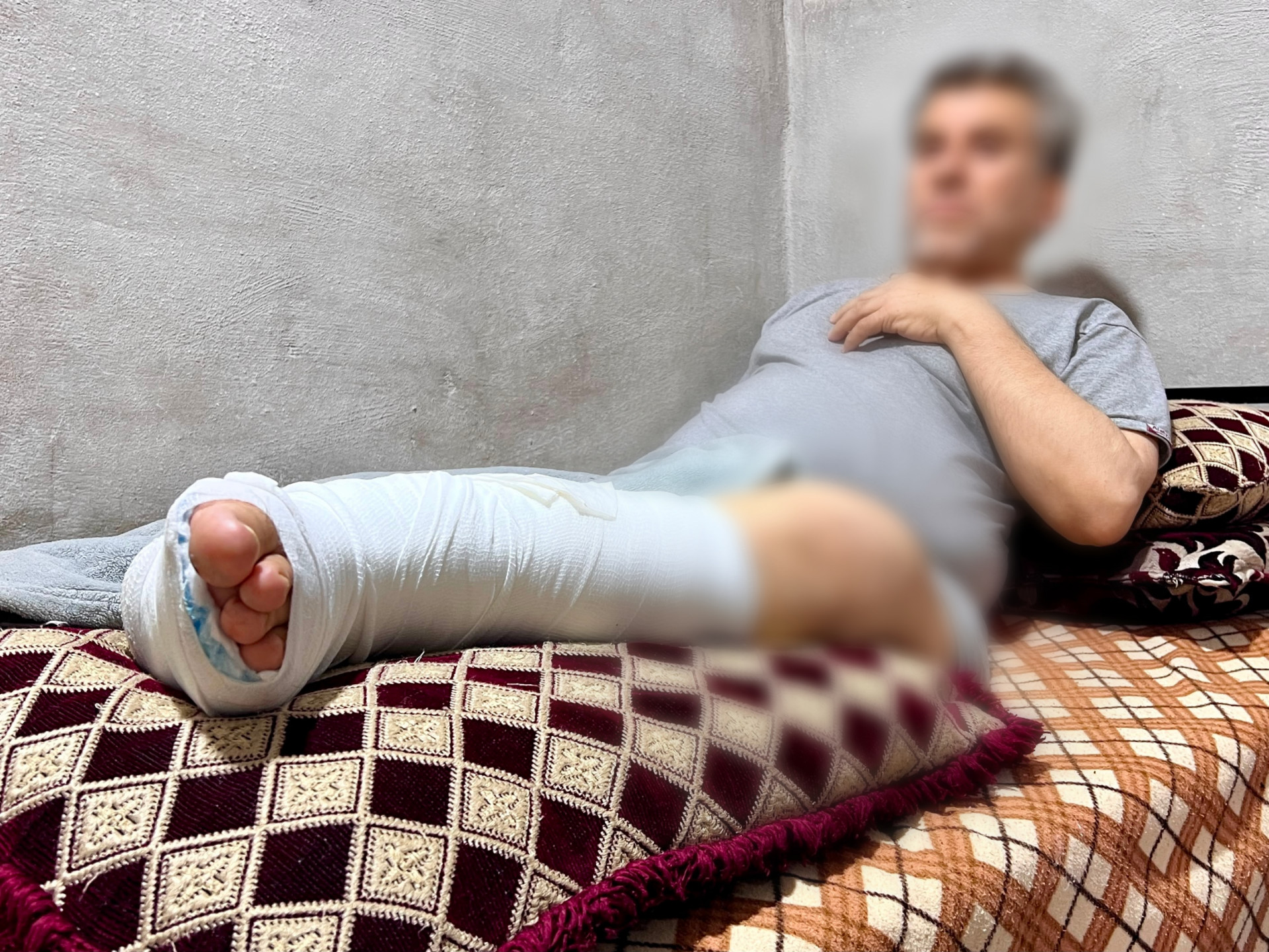 إصابة خطيرة تلاها التهاب يهدد القدم