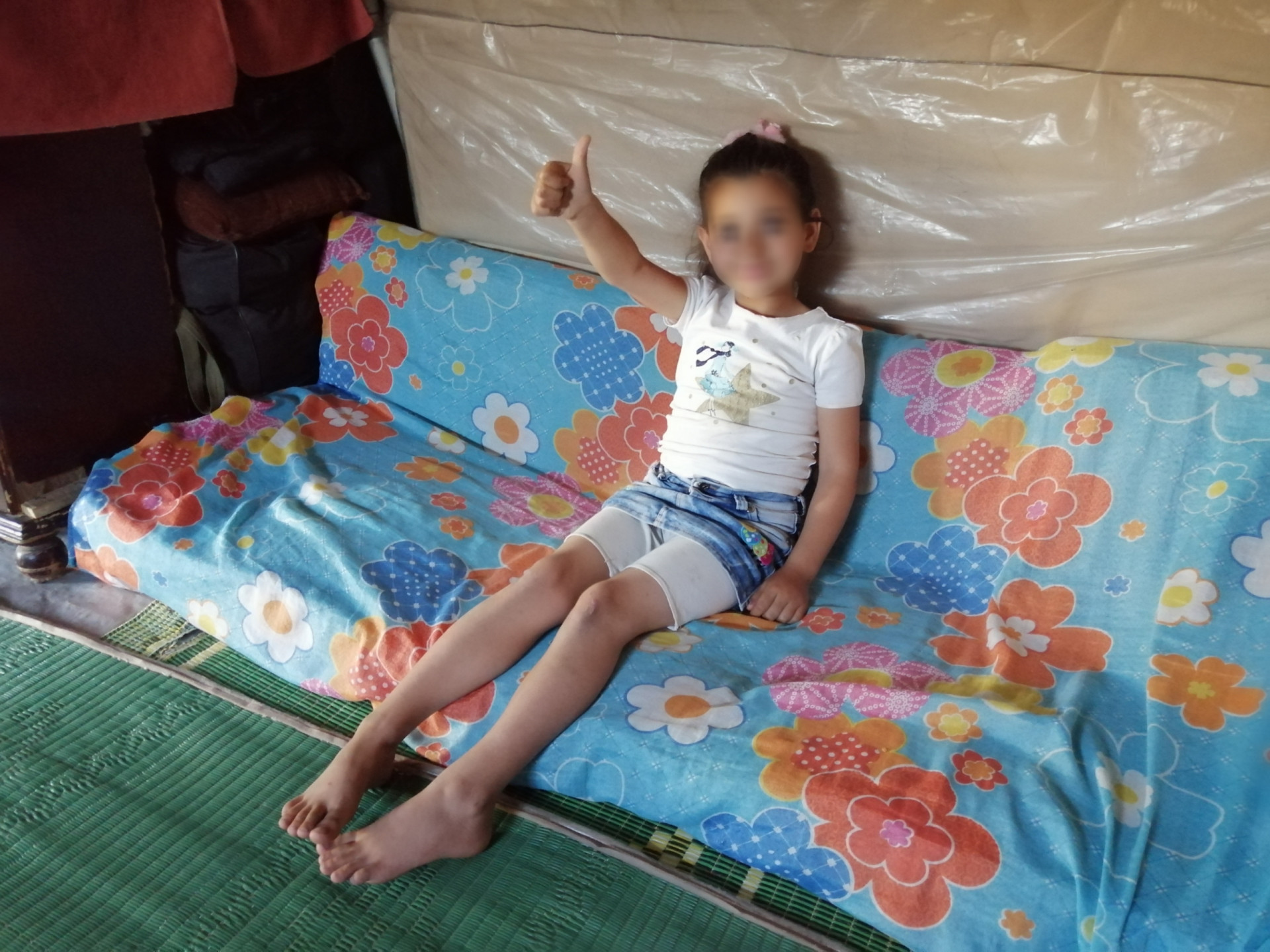 Shahad suffers from a weakness in her left hand.