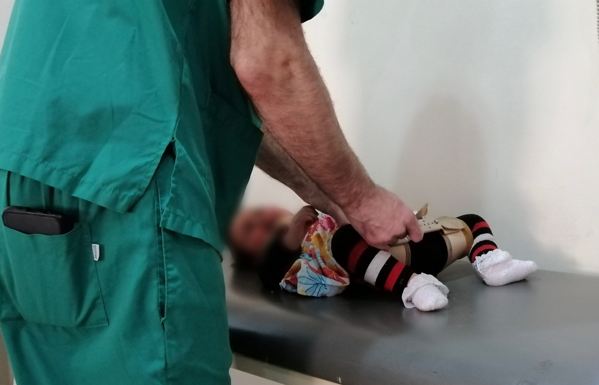 Jana is a little baby suffers from hip dislocation, needs surgery