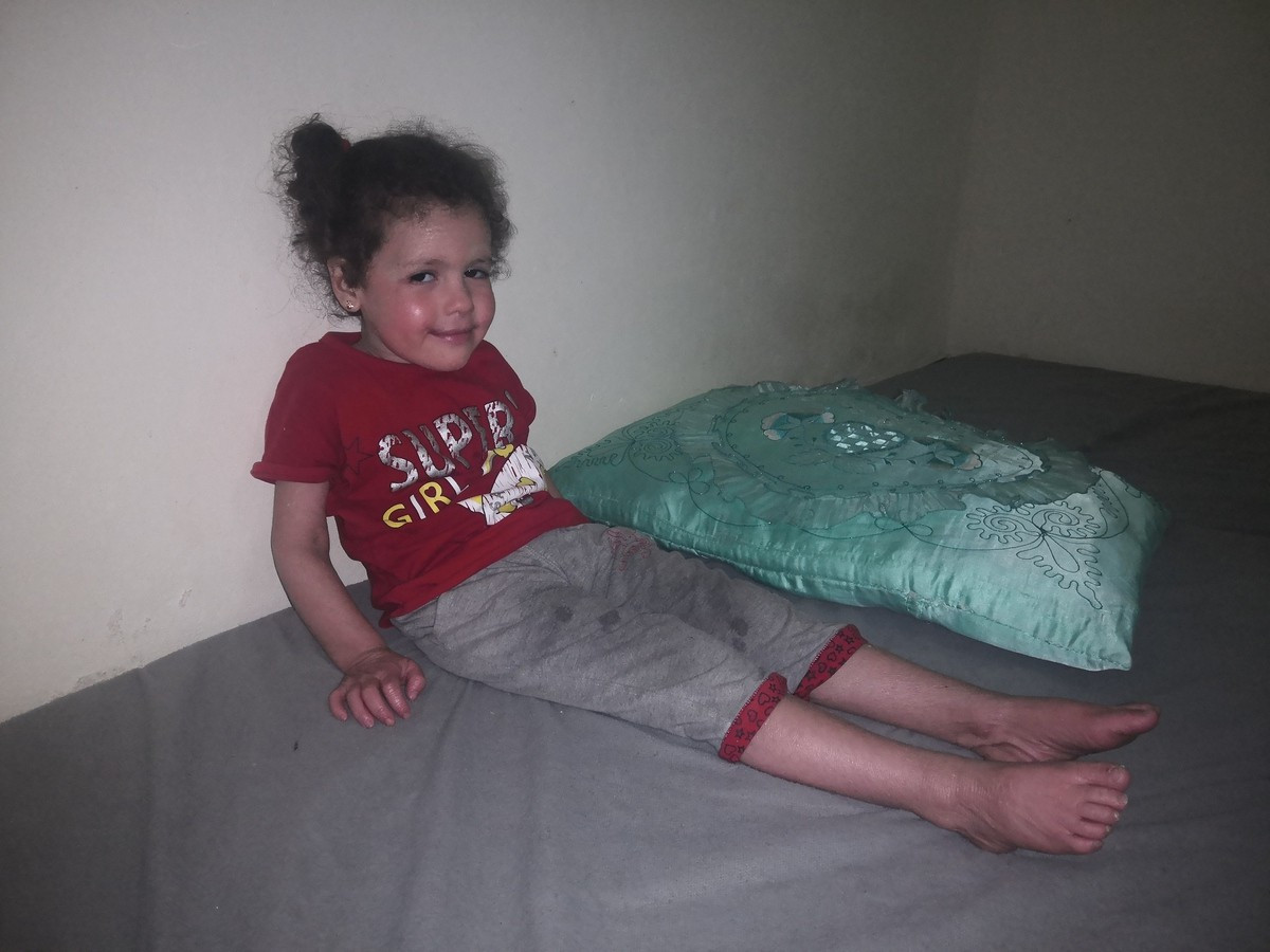 A girl with a serious dermatological disease