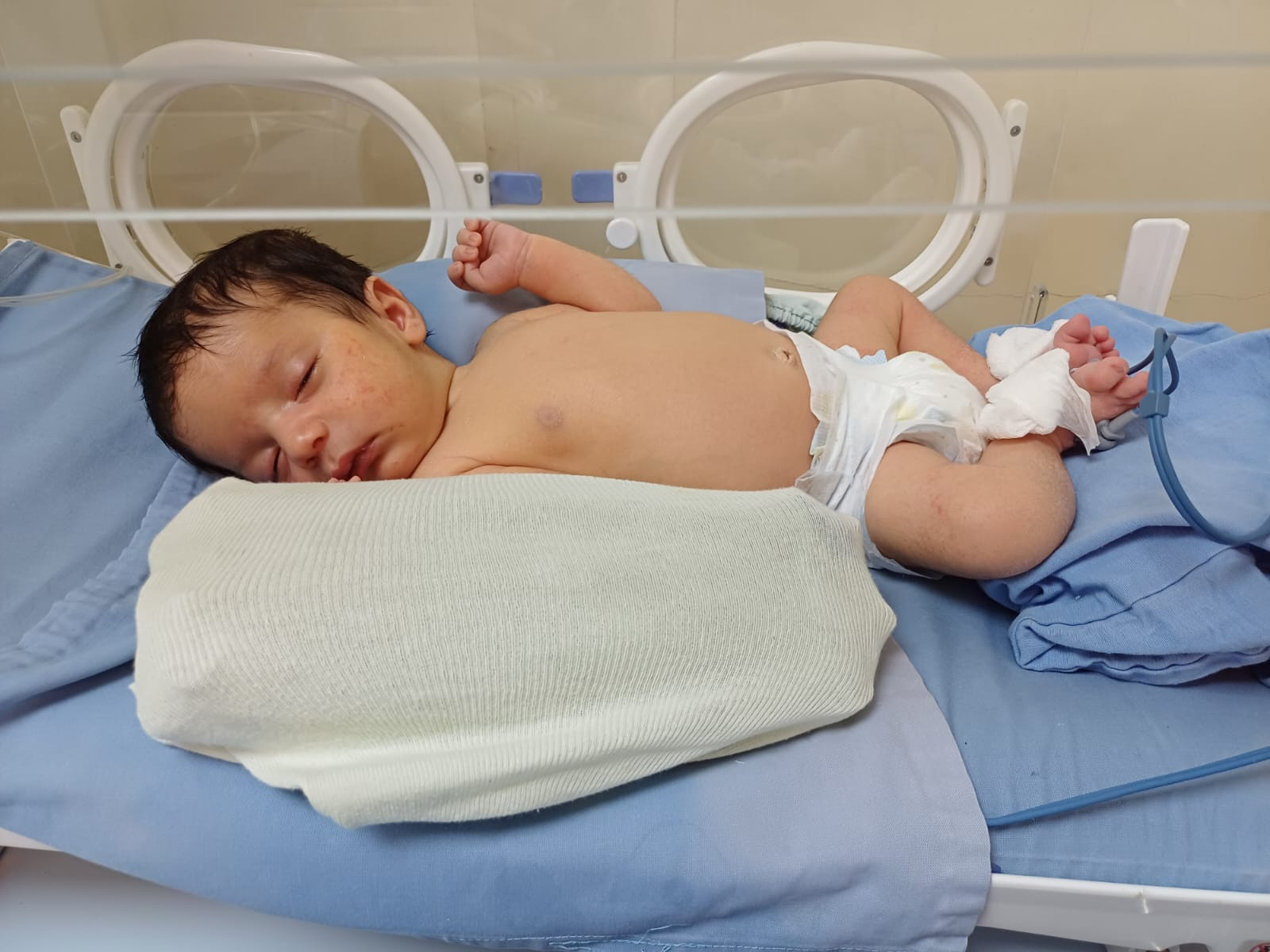 صغيرنا خالد بحاجة لمساندتكم في علاجه وتخفيف آلامه