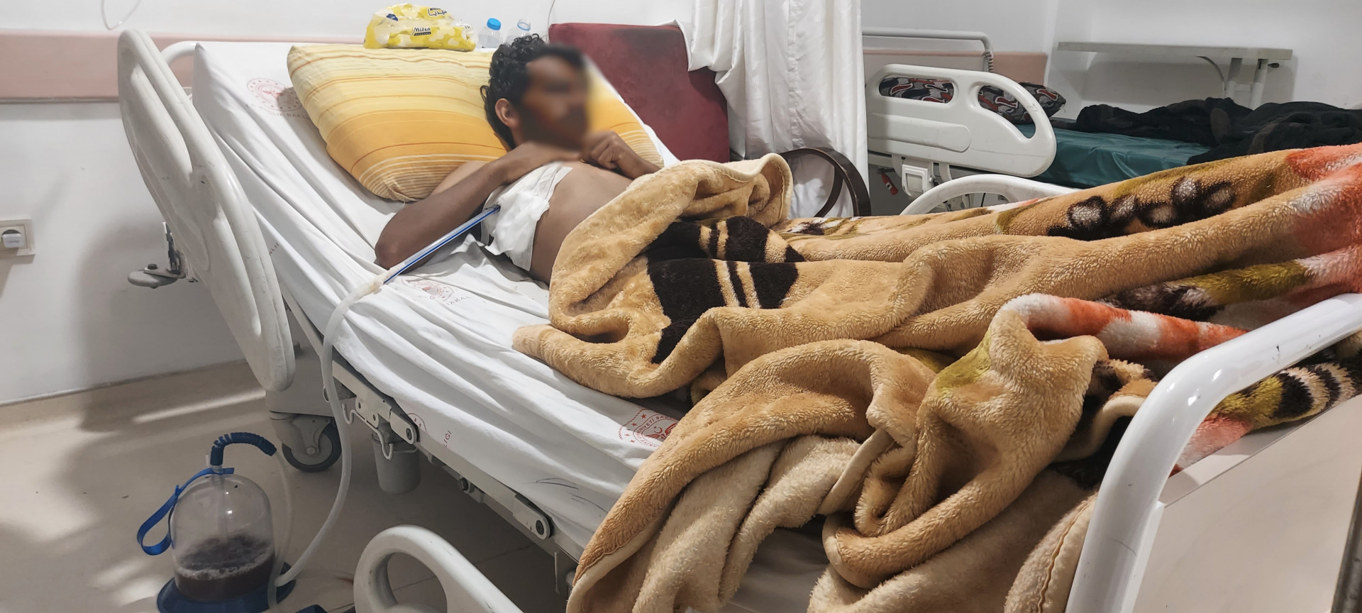 Ismaeel has a lung damage due to an accident