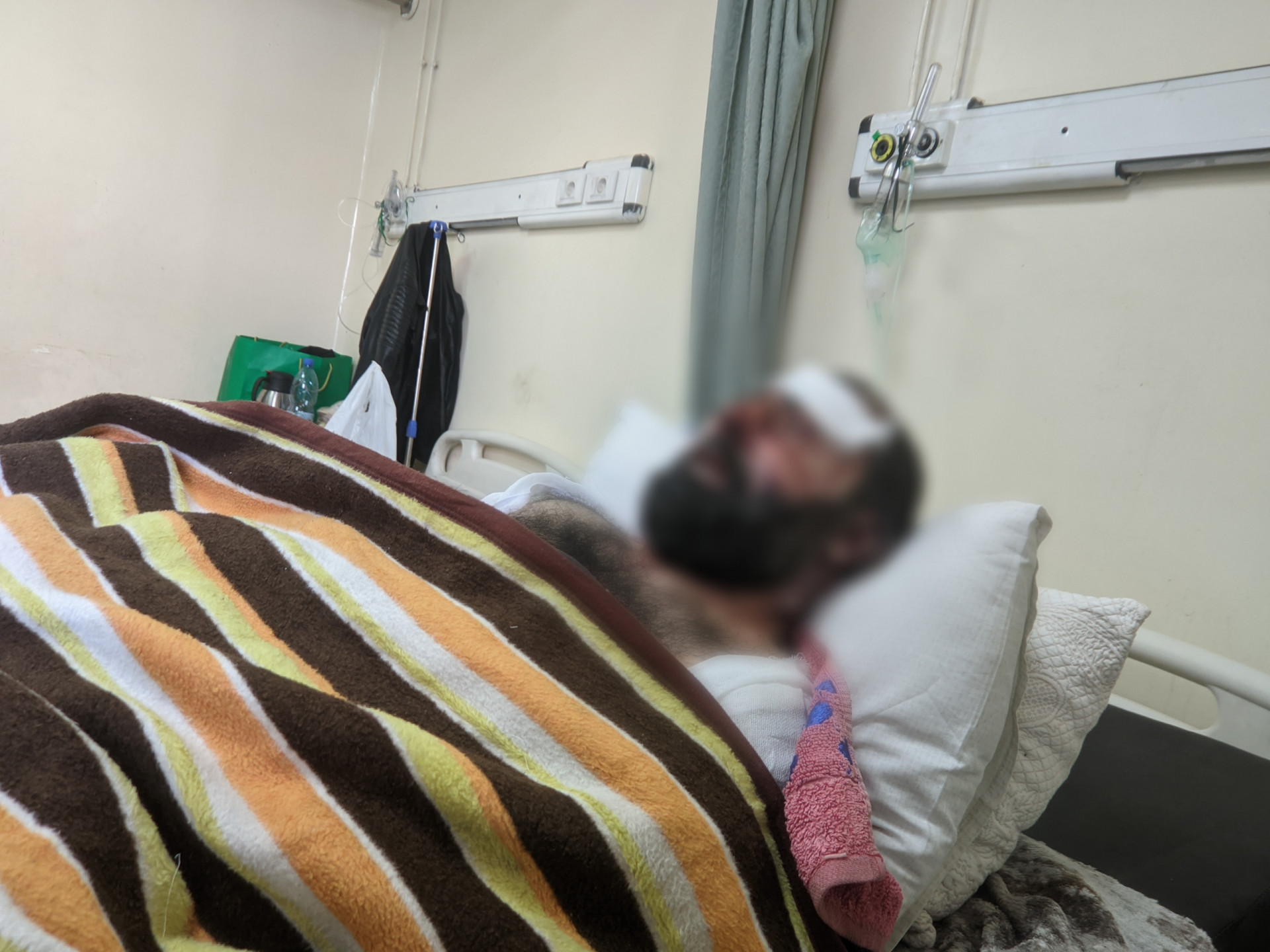 حريقٌ سرق صحة علاء