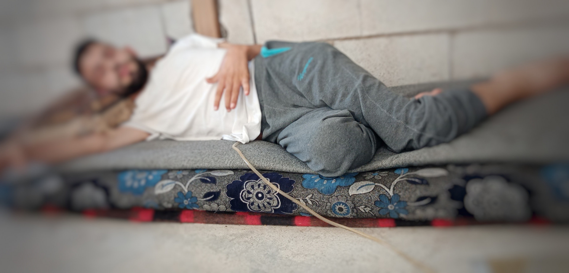 محمد شاب من ذوي الاحتياجات الخاصة، يعاني من وجود بحصة في المثانة، وهو بحاجة إلى عمل جراحي لإخراجها