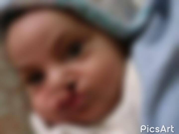 Infant needing surgery