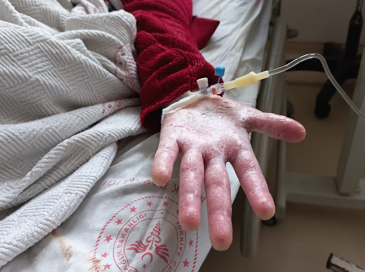 man is in constant pain throughout the day and needs your help!