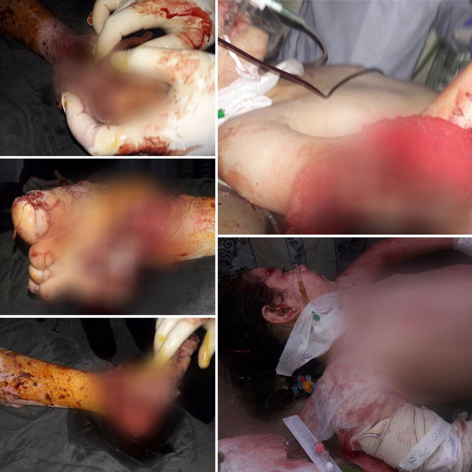 A child in need for an urgent surgery