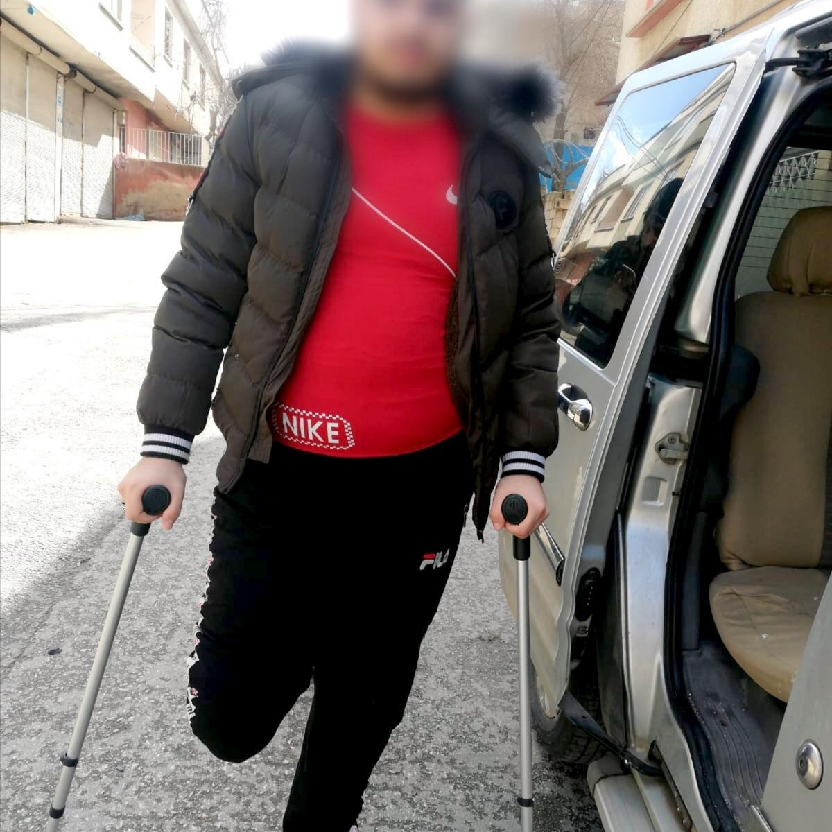 a young man lost his leg and his home