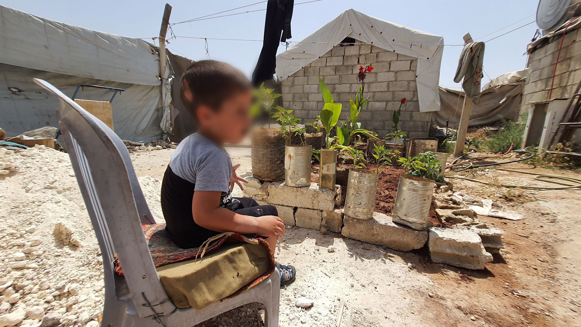 A little boy lives in a tent, suffers from hydrocephalus in need of urgent surgery.