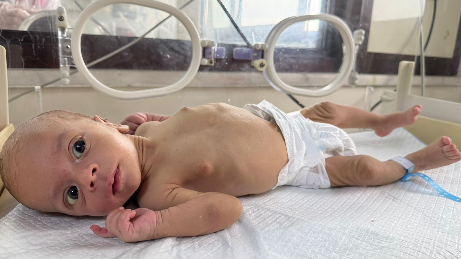 Urgent Humanitarian Cases