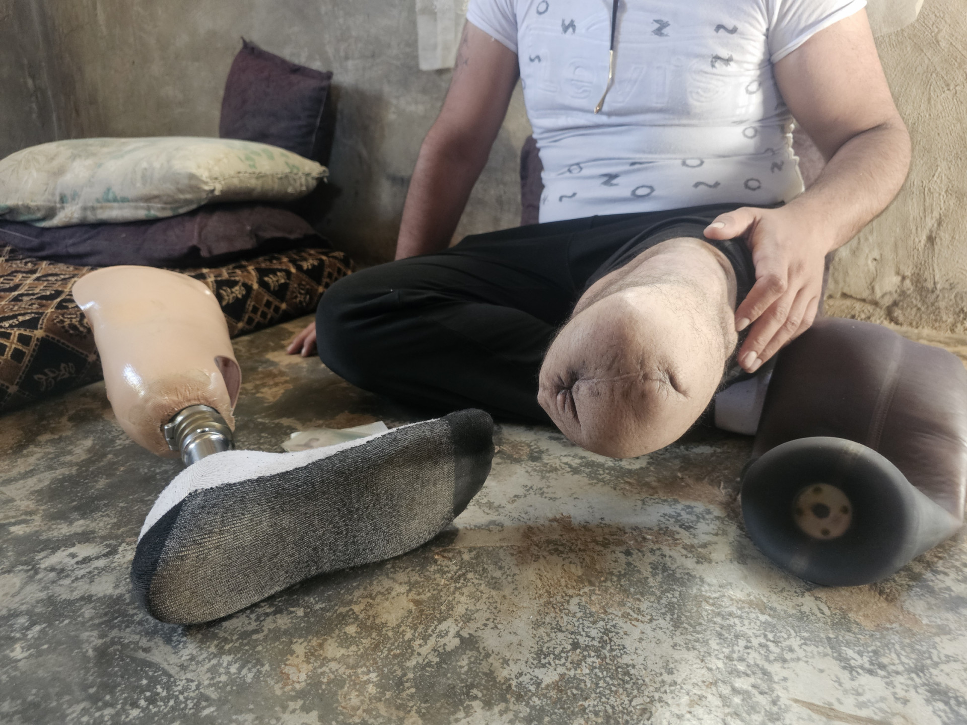 كيف يعيل أطفاله بعد فقدان ساقه؟