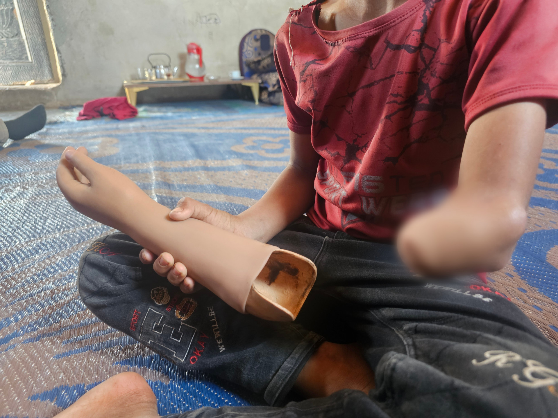 A Displaced Father Supporting an Injured Child