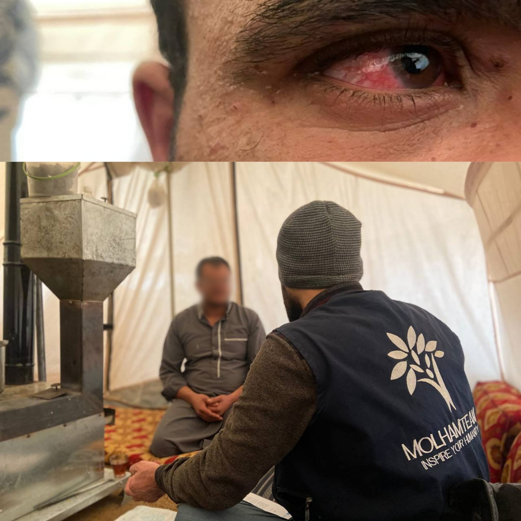 Khalid is with corneal disease, needs surgery