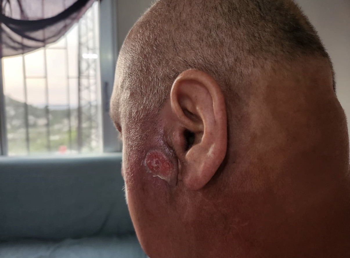 Cancer After Displacement — Help Uncle Kinan Keep Fighting