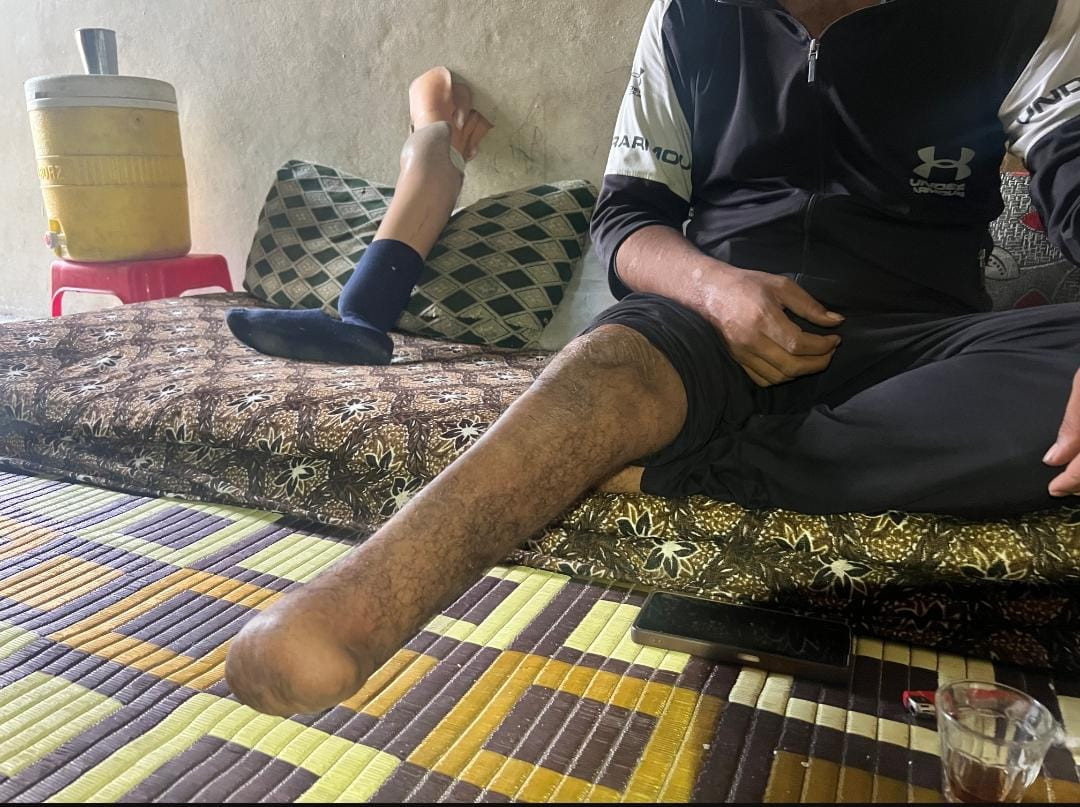 إصابة محمود أنهت قدرته على العمل