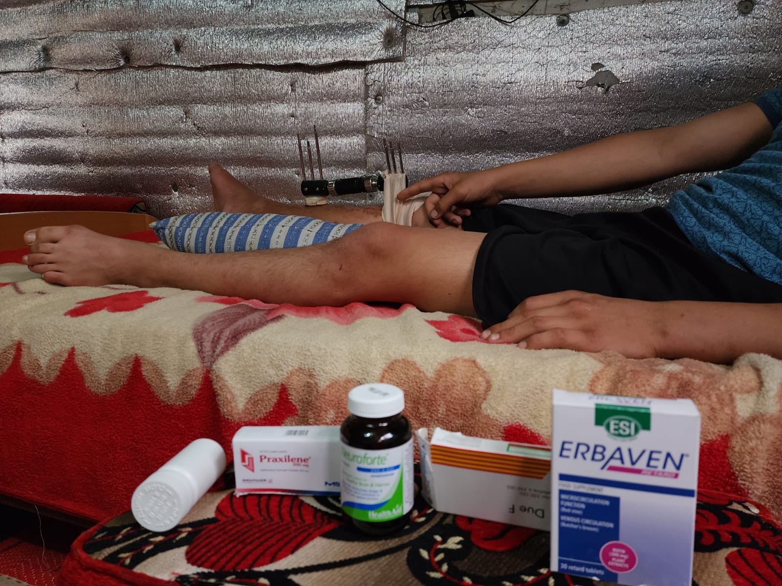 Omar had a traffic accident that caused him multiple injuries!