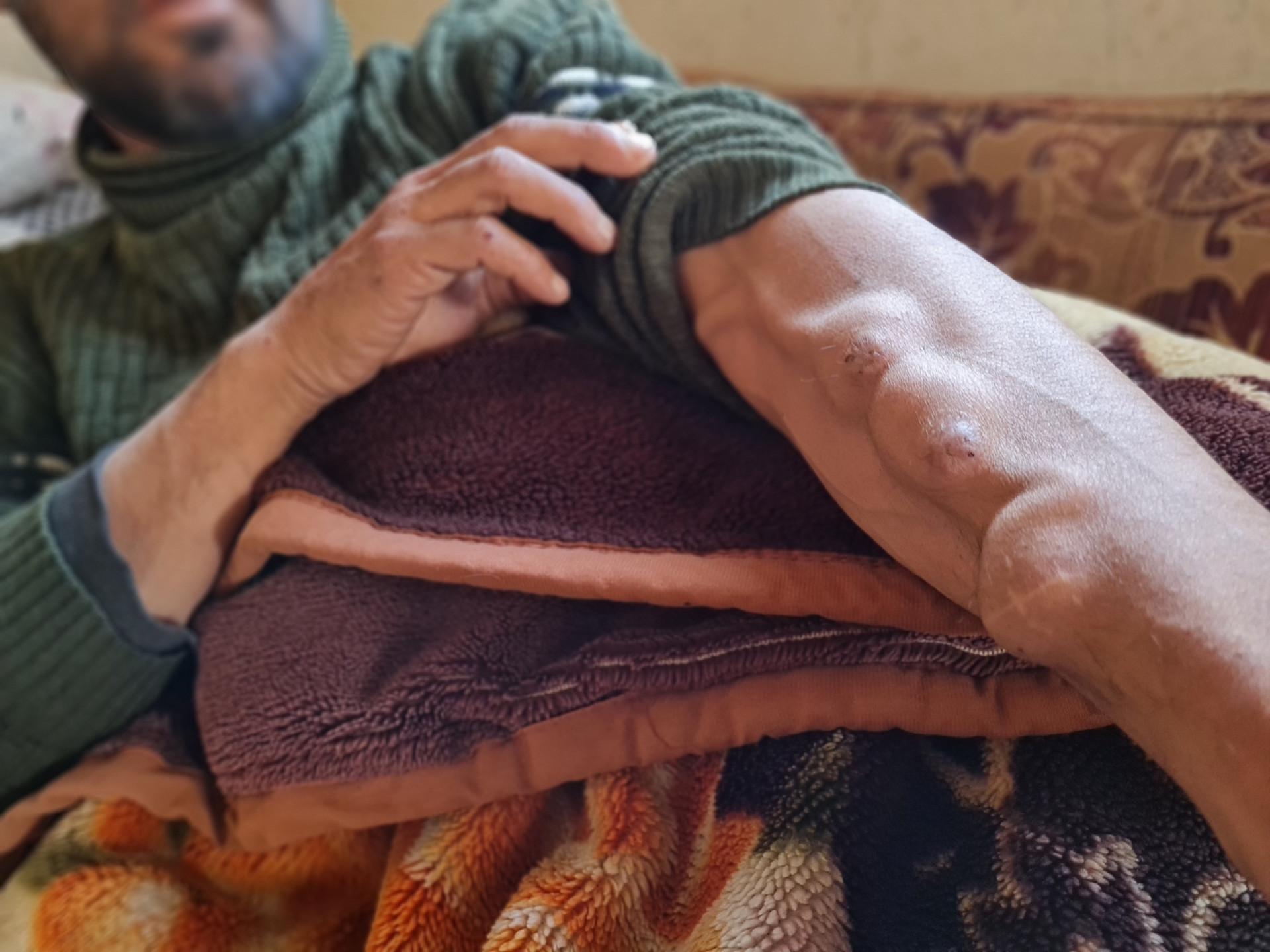 Ahmad is ill and needs your help for medicine