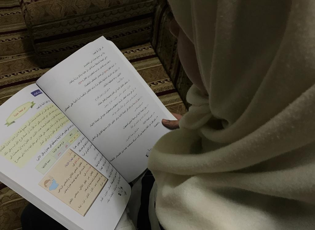 طفلة تعاني من حول في عينيها!